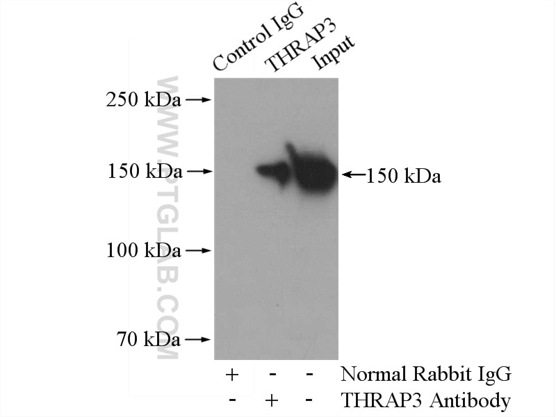 Immunoprecipitation (IP) experiment of HeLa cells using THRAP3 Polyclonal antibody (19744-1-AP)