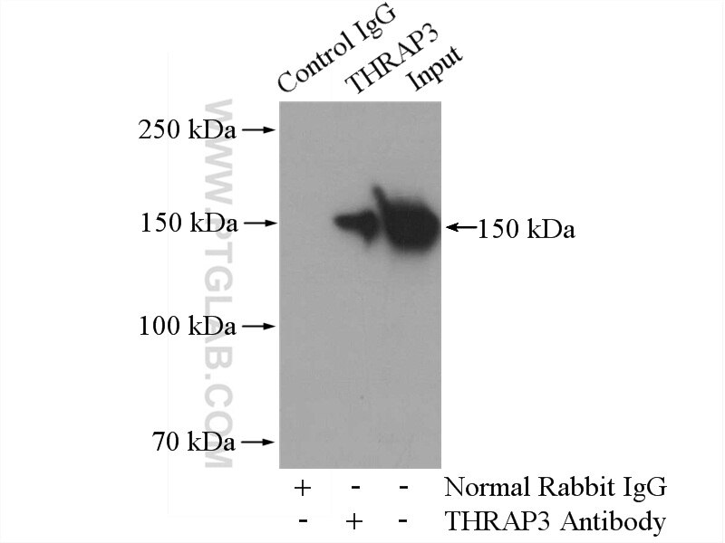 Immunoprecipitation (IP) experiment of HeLa cells using THRAP3 Polyclonal antibody (19744-1-AP)