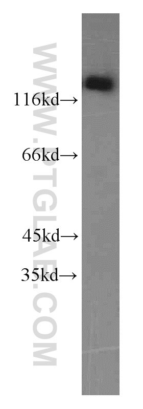 Western Blot (WB) analysis of HeLa cells using THRAP3 Polyclonal antibody (19744-1-AP)