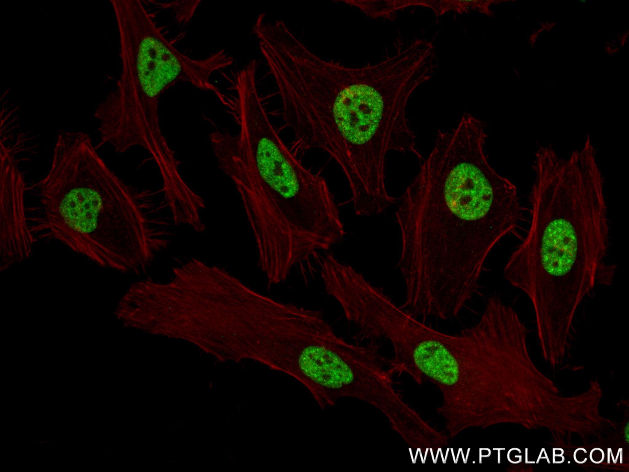 Immunofluorescence (IF) / fluorescent staining of HeLa cells using THRAP3 Recombinant antibody (85093-1-RR)
