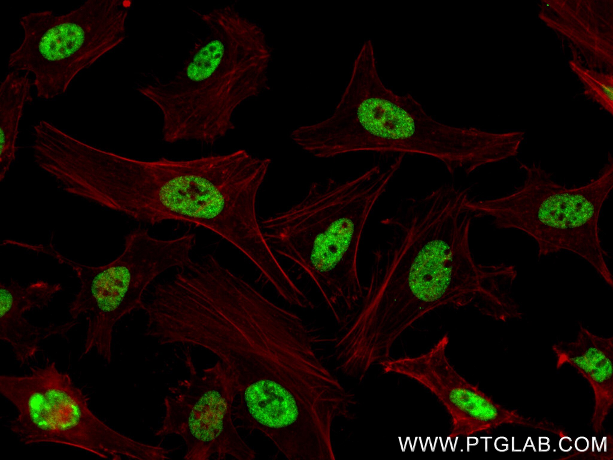 Immunofluorescence (IF) / fluorescent staining of HeLa cells using THRAP3 Recombinant antibody (85093-2-RR)