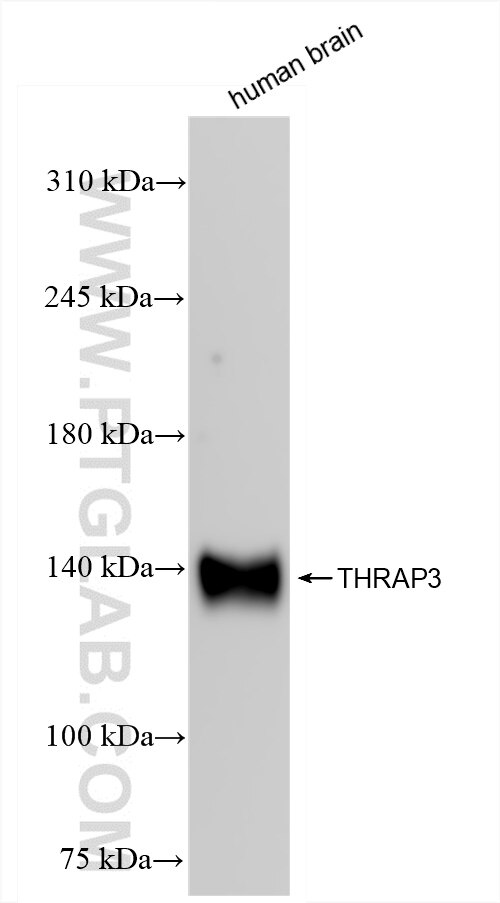 Western Blot (WB) analysis of human brain tissue using THRAP3 Recombinant antibody (85093-2-RR)