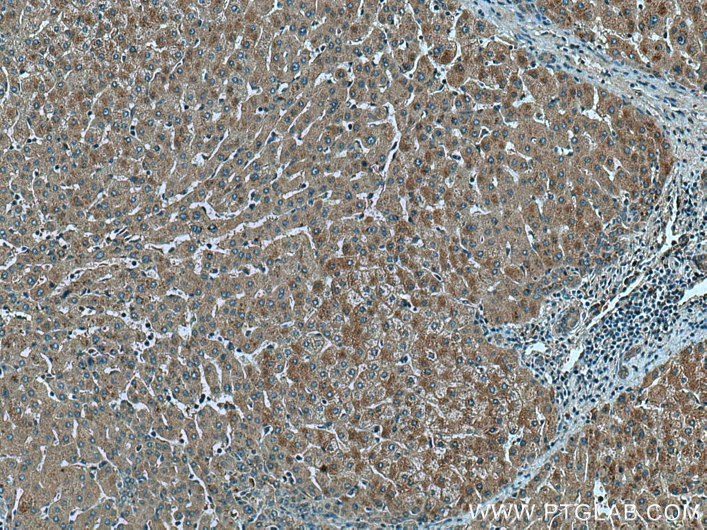 Immunohistochemistry (IHC) staining of human liver tissue using THRSP Polyclonal antibody (13054-1-AP)