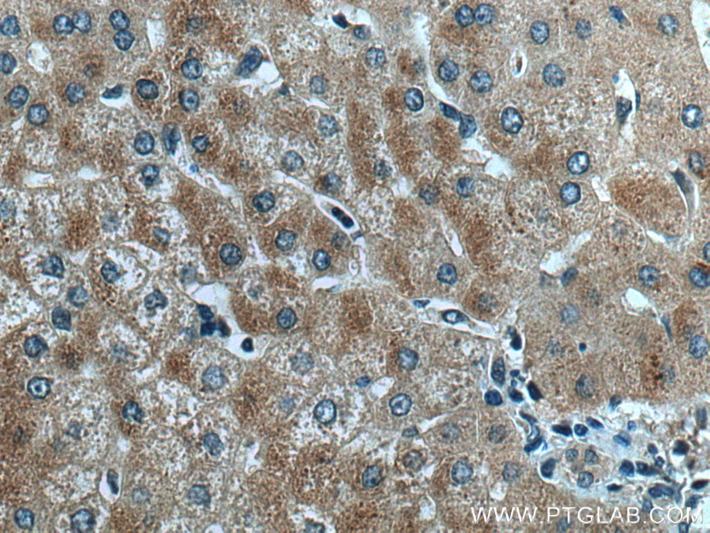Immunohistochemistry (IHC) staining of human liver tissue using THRSP Polyclonal antibody (13054-1-AP)