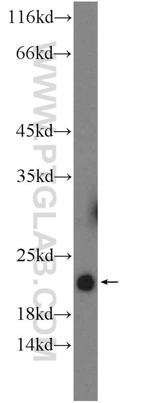 Western Blot (WB) analysis of mouse liver tissue using THRSP Polyclonal antibody (13054-1-AP)