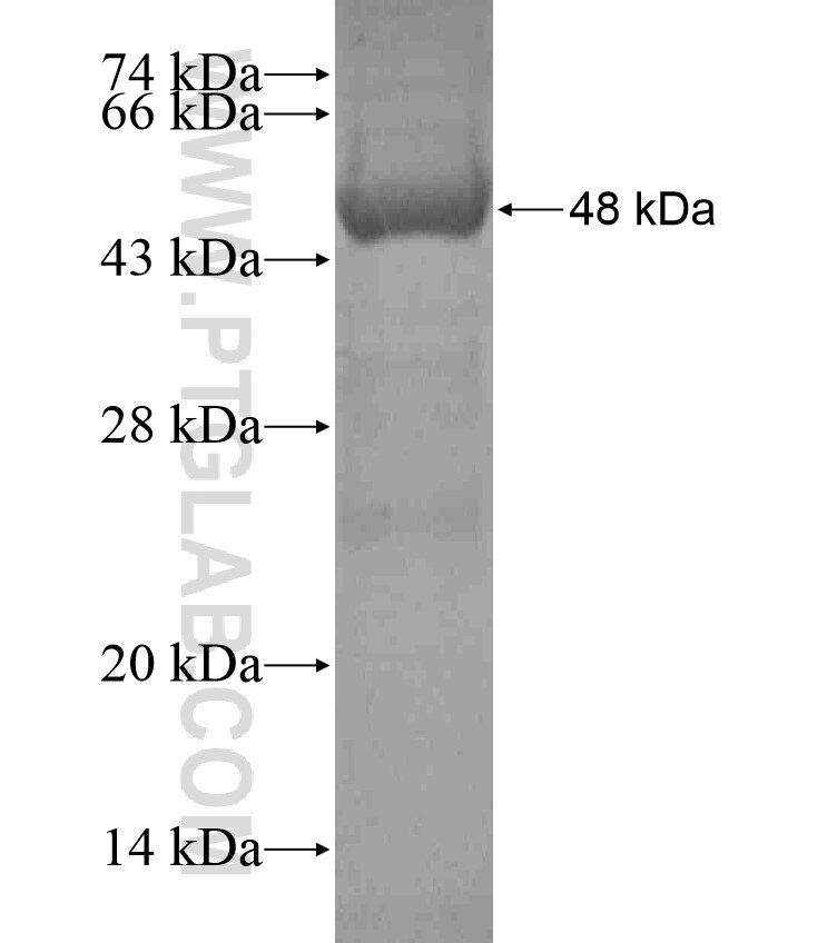 THSD1 fusion protein Ag17631 SDS-PAGE