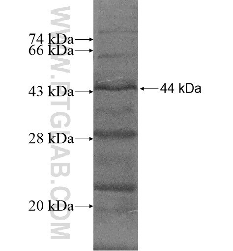 THSD4 fusion protein Ag15139 SDS-PAGE