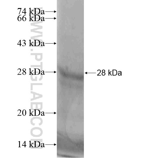 THSD4 fusion protein Ag19764 SDS-PAGE