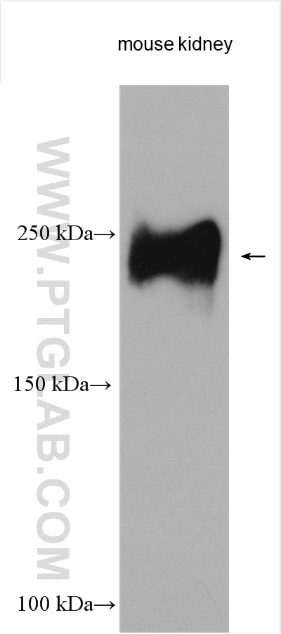 Western Blot (WB) analysis of various lysates using THSD7A Polyclonal antibody (28524-1-AP)