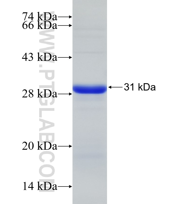 THSD7A fusion protein Ag29107 SDS-PAGE