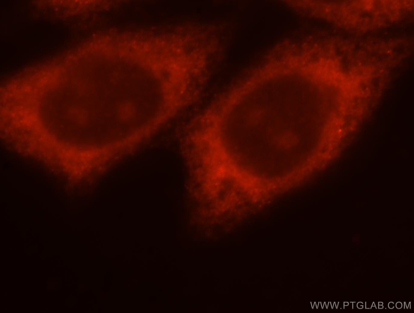 Immunofluorescence (IF) / fluorescent staining of HepG2 cells using THTPA Polyclonal antibody (15486-1-AP)