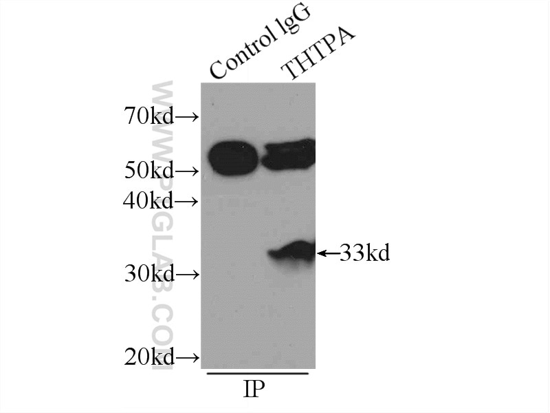 Immunoprecipitation (IP) experiment of K-562 cells using THTPA Polyclonal antibody (15486-1-AP)