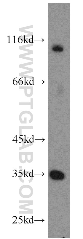 Western Blot (WB) analysis of mouse testis tissue using THTPA Polyclonal antibody (15486-1-AP)