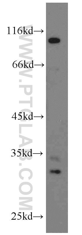 Western Blot (WB) analysis of HeLa cells using THTPA Polyclonal antibody (15486-1-AP)