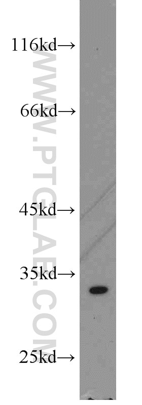 Western Blot (WB) analysis of K-562 cells using THTPA Polyclonal antibody (15486-1-AP)
