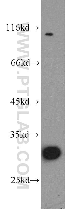 Western Blot (WB) analysis of mouse uterus tissue using THTPA Polyclonal antibody (15486-1-AP)