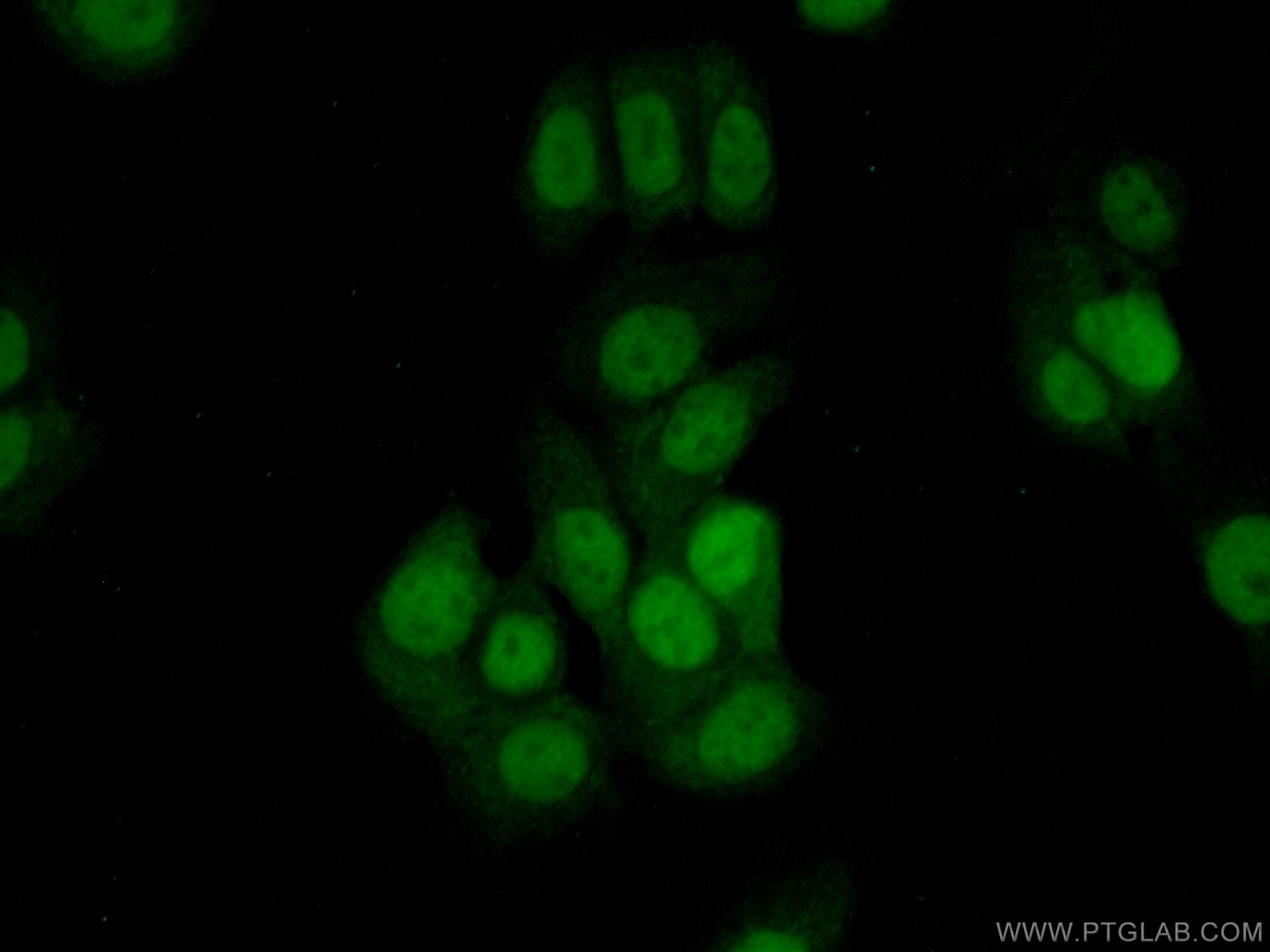 Immunofluorescence (IF) / fluorescent staining of MCF-7 cells using THUMPD1 Polyclonal antibody (14921-1-AP)