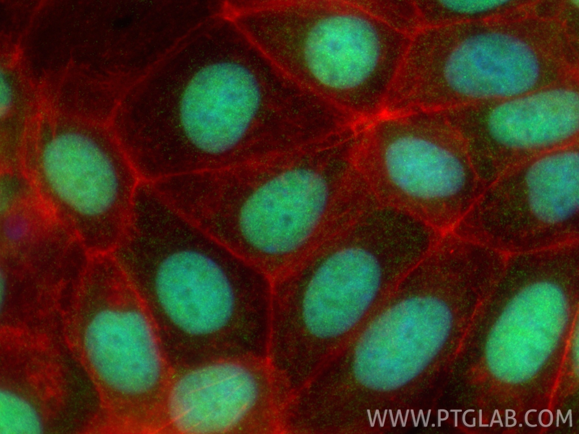 Immunofluorescence (IF) / fluorescent staining of MCF-7 cells using THUMPD1 Polyclonal antibody (14921-1-AP)