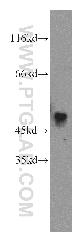 Western Blot (WB) analysis of K-562 cells using THUMPD1 Polyclonal antibody (14921-1-AP)