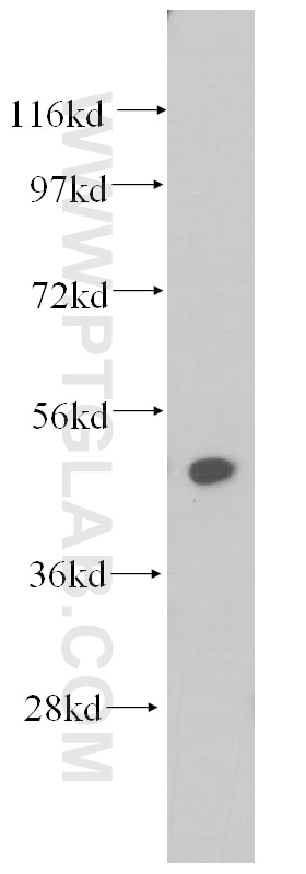 Western Blot (WB) analysis of MCF-7 cells using THUMPD1 Polyclonal antibody (14921-1-AP)