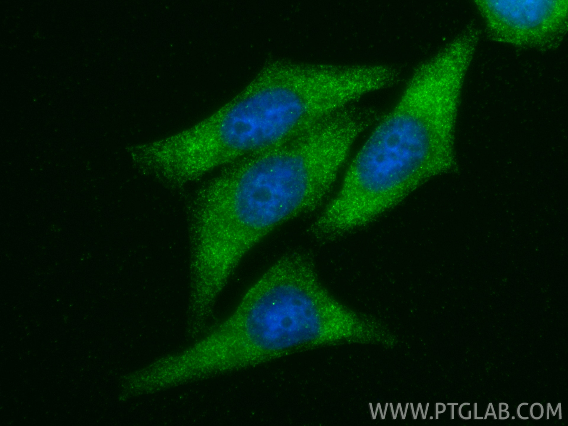 IF Staining of HepG2 using 19807-1-AP Immunofluorescence (IF) / fluorescent staining of HepG2 cells using THUMPD3 Polyclonal antibody (19807-1-AP)