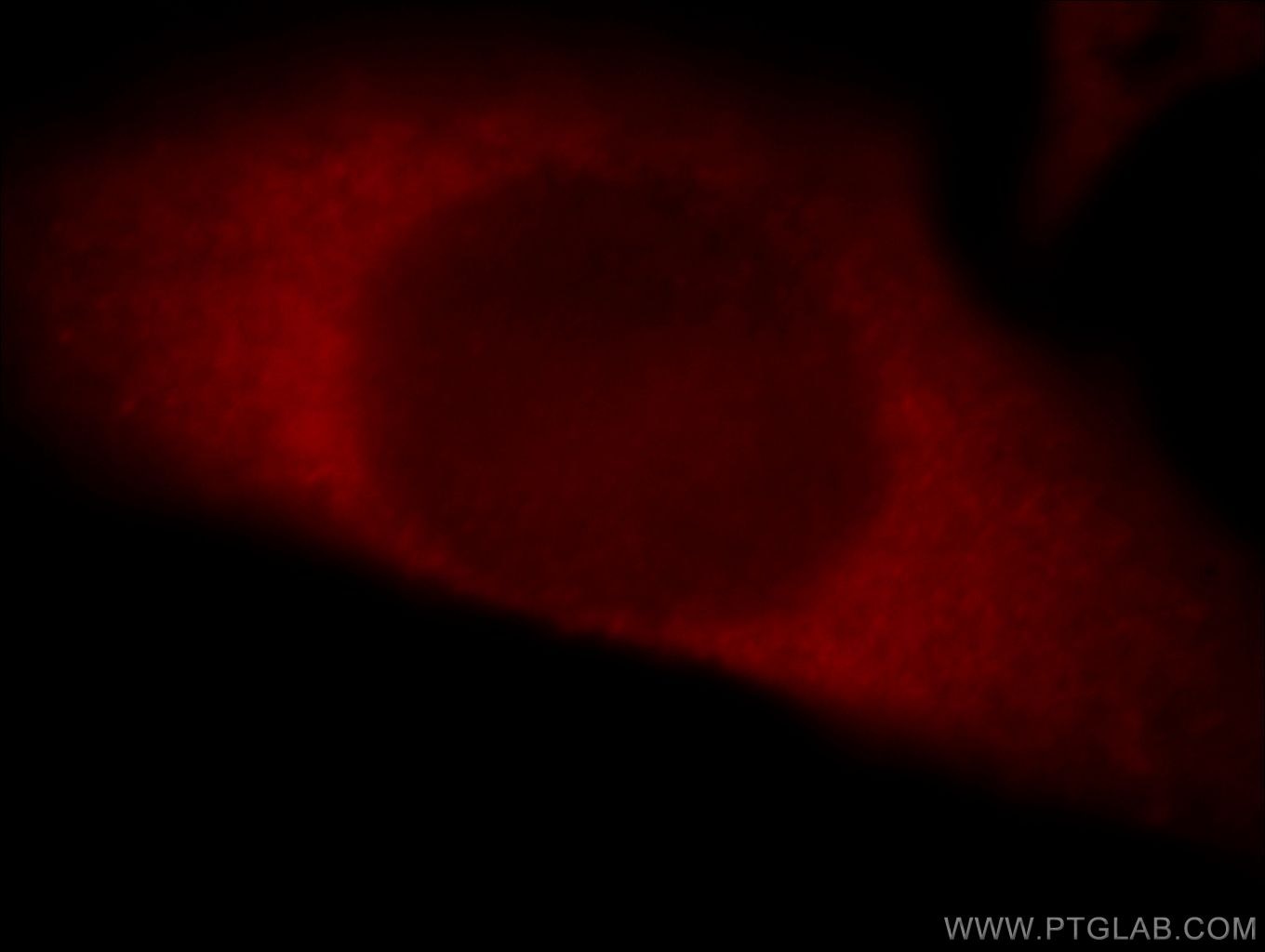 Immunofluorescence (IF) / fluorescent staining of HeLa cells using THUMPD3 Polyclonal antibody (19807-1-AP)