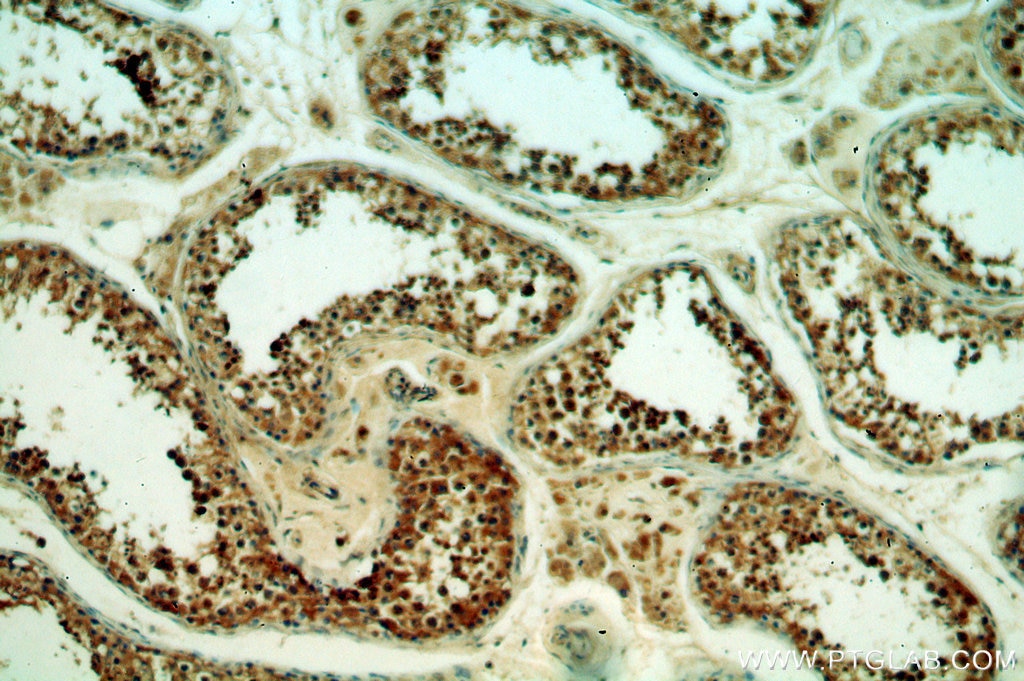 Immunohistochemistry (IHC) staining of human testis tissue using THUMPD3 Polyclonal antibody (19807-1-AP)