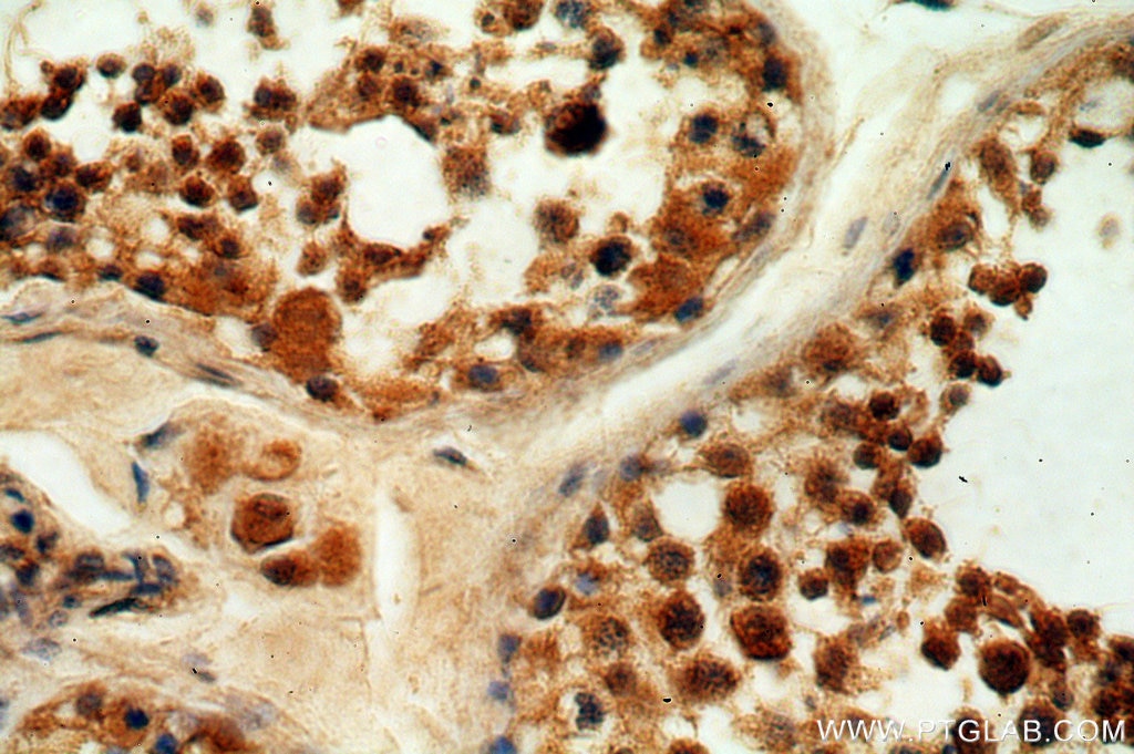 Immunohistochemistry (IHC) staining of human testis tissue using THUMPD3 Polyclonal antibody (19807-1-AP)