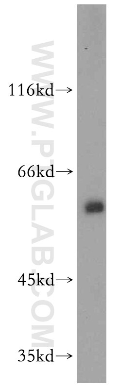 Western Blot (WB) analysis of HeLa cells using THUMPD3 Polyclonal antibody (19807-1-AP)