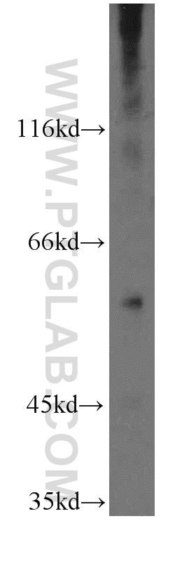 Western Blot (WB) analysis of mouse kidney tissue using THUMPD3 Polyclonal antibody (19807-1-AP)