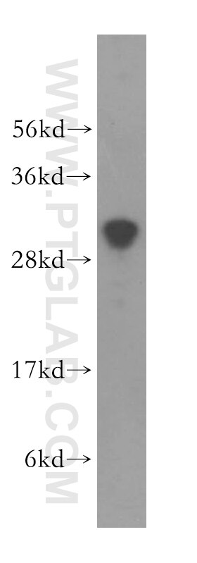 WB analysis of HEK-293 using 15867-1-AP