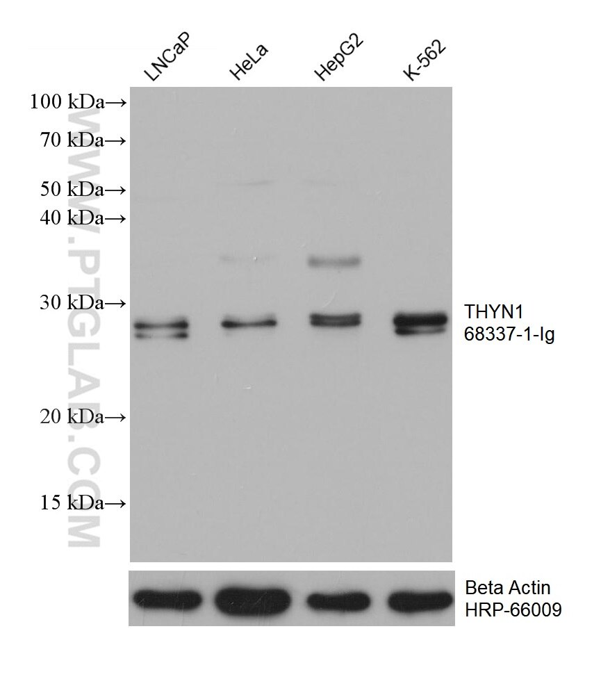 Western Blot (WB) analysis of various lysates using THYN1 Monoclonal antibody (68337-1-Ig)