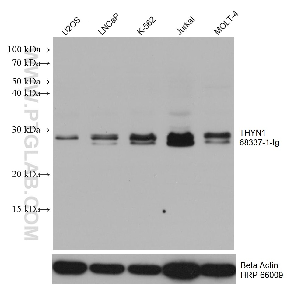 Western Blot (WB) analysis of various lysates using THYN1 Monoclonal antibody (68337-1-Ig)