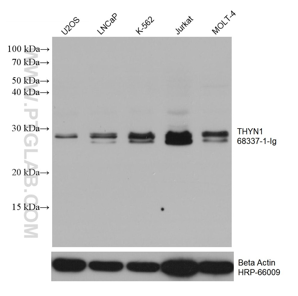 WB analysis using 68337-1-Ig