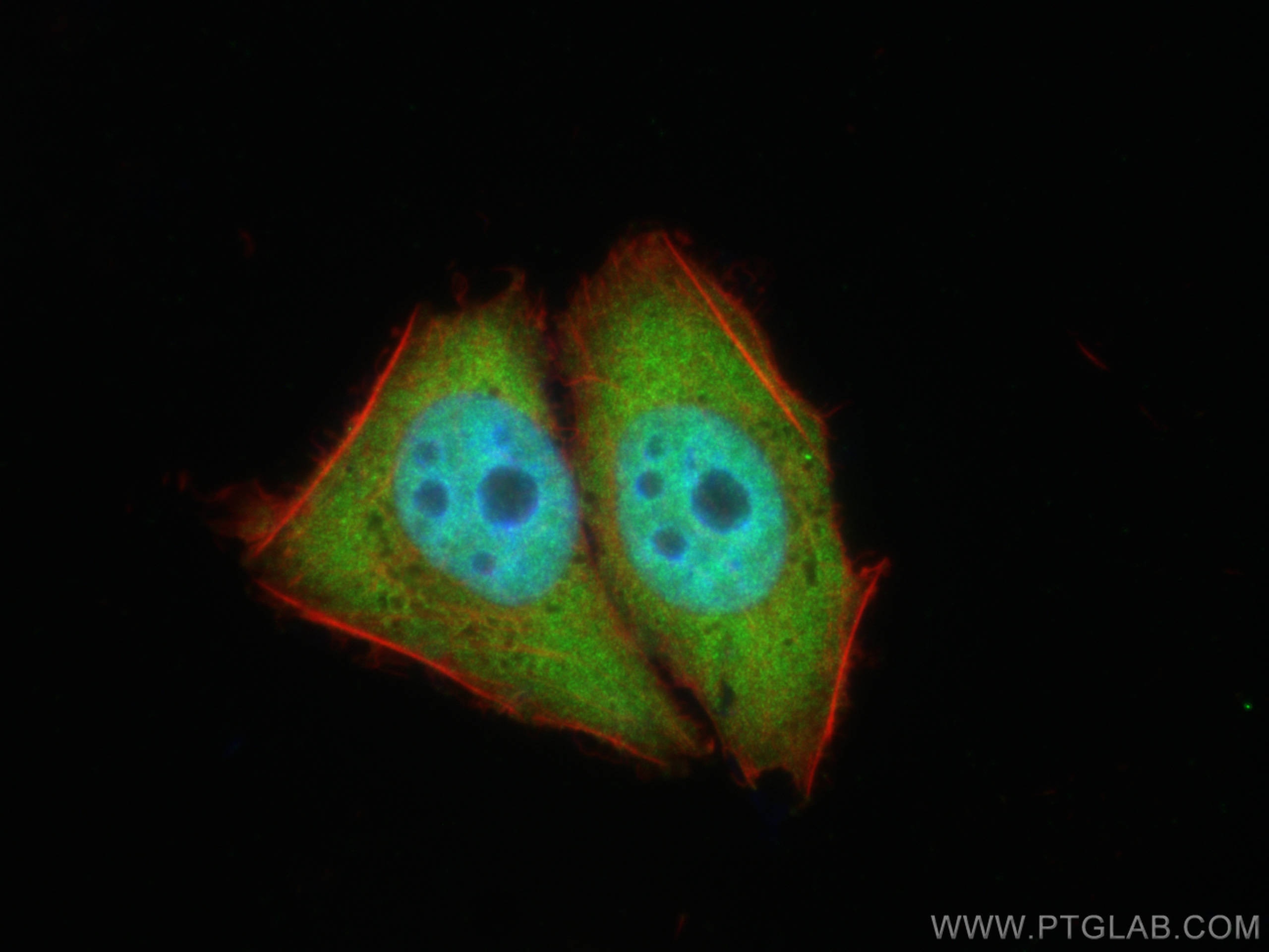 Immunofluorescence (IF) / fluorescent staining of L02 cells using TIA1 Polyclonal antibody (12133-2-AP)