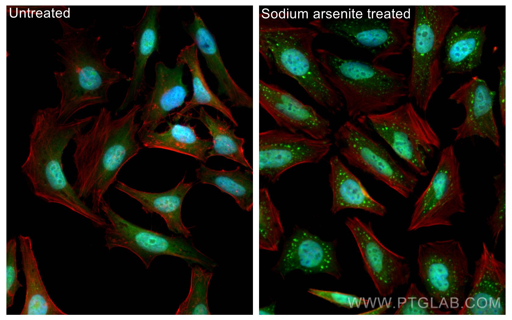Immunofluorescence (IF) / fluorescent staining of HeLa cells using TIA1 Polyclonal antibody (12133-2-AP)