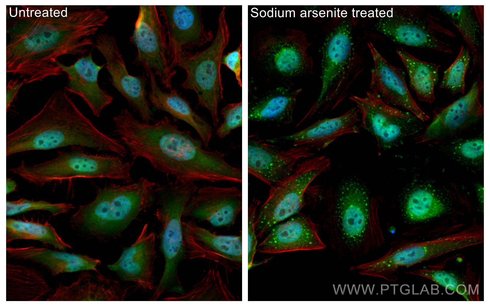 Immunofluorescence (IF) / fluorescent staining of HeLa cells using TIA1 Polyclonal antibody (12133-2-AP)