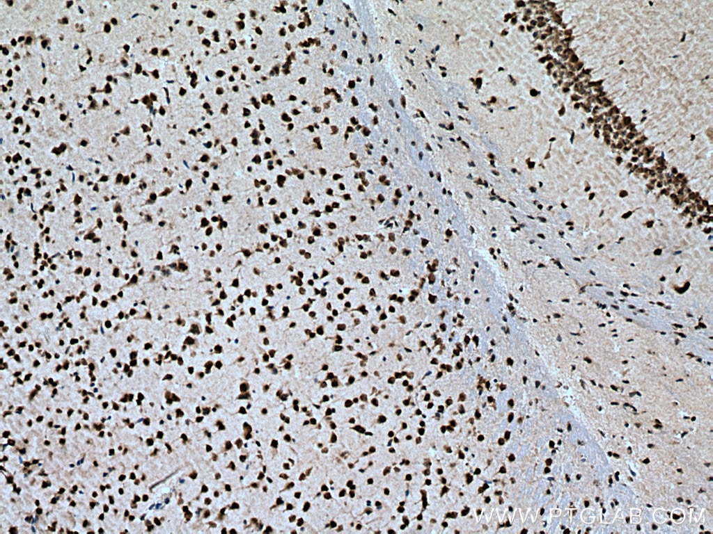 Immunohistochemistry (IHC) staining of mouse brain tissue using TIA1 Polyclonal antibody (12133-2-AP)