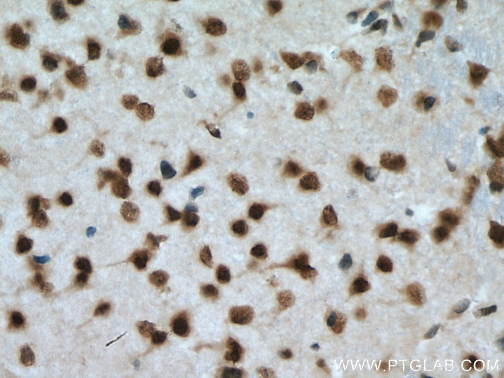 Immunohistochemistry (IHC) staining of mouse brain tissue using TIA1 Polyclonal antibody (12133-2-AP)