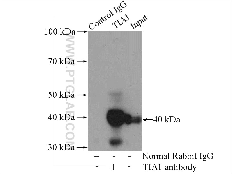 Immunoprecipitation (IP) experiment of Jurkat cells using TIA1 Polyclonal antibody (12133-2-AP)
