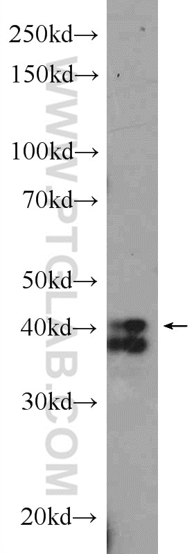 WB analysis of mouse spleen using 12133-2-AP