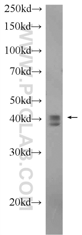 Western Blot (WB) analysis of mouse thymus tissue using TIA1 Polyclonal antibody (12133-2-AP)