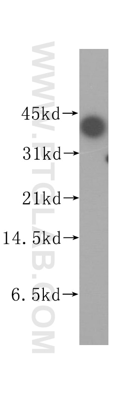 TIA1 Polyclonal antibody