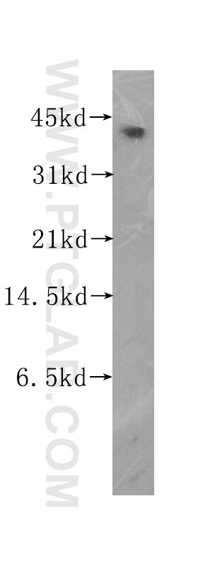 Western Blot (WB) analysis of Raji cells using TIA1 Polyclonal antibody (12133-2-AP)