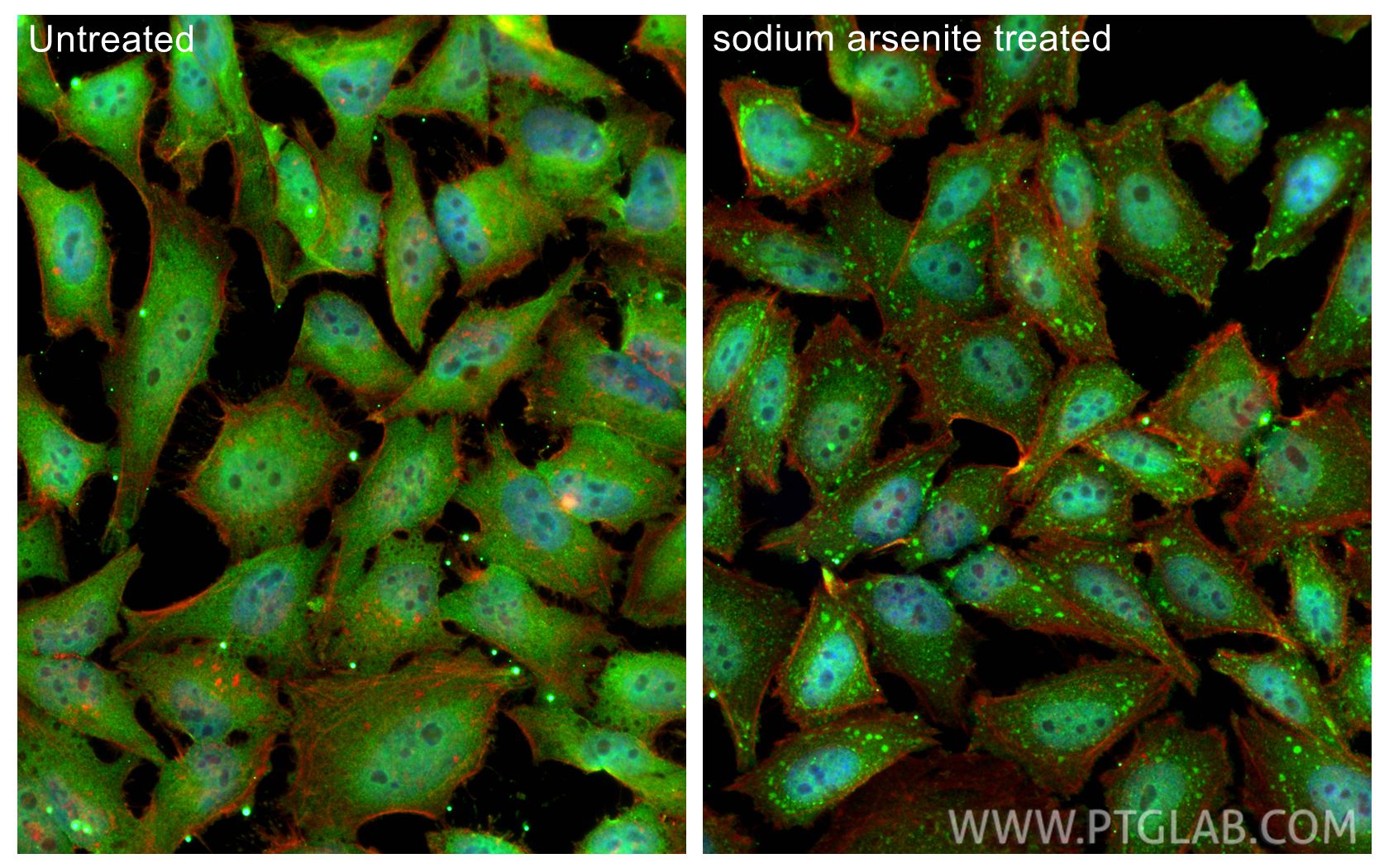 IF Staining of HeLa using 68486-1-Ig (same clone as 68486-1-PBS) Immunofluorescence (IF) / fluorescent staining of HeLa cells using TIA1 Monoclonal antibody (68486-1-Ig)