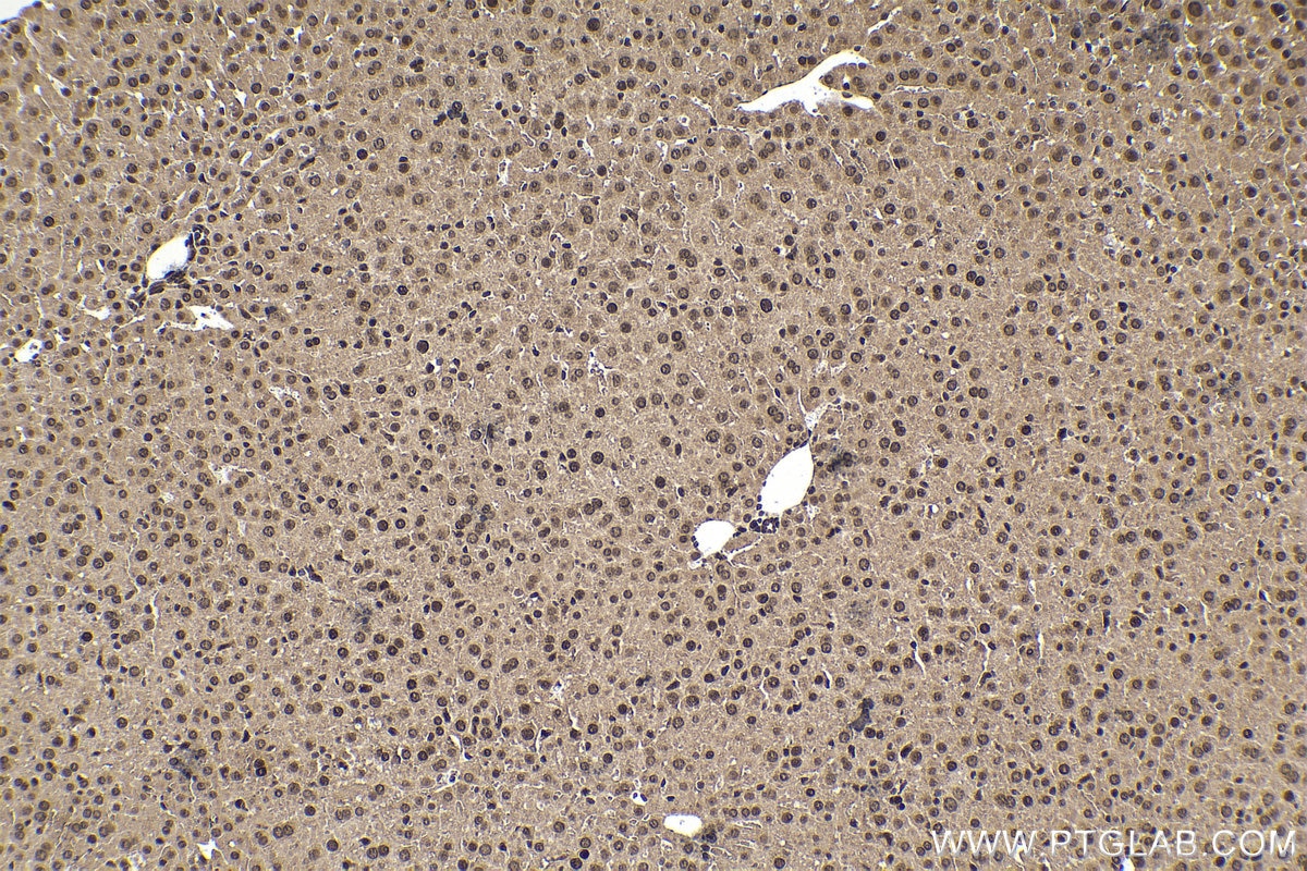 IHC staining of mouse liver using 68486-1-Ig