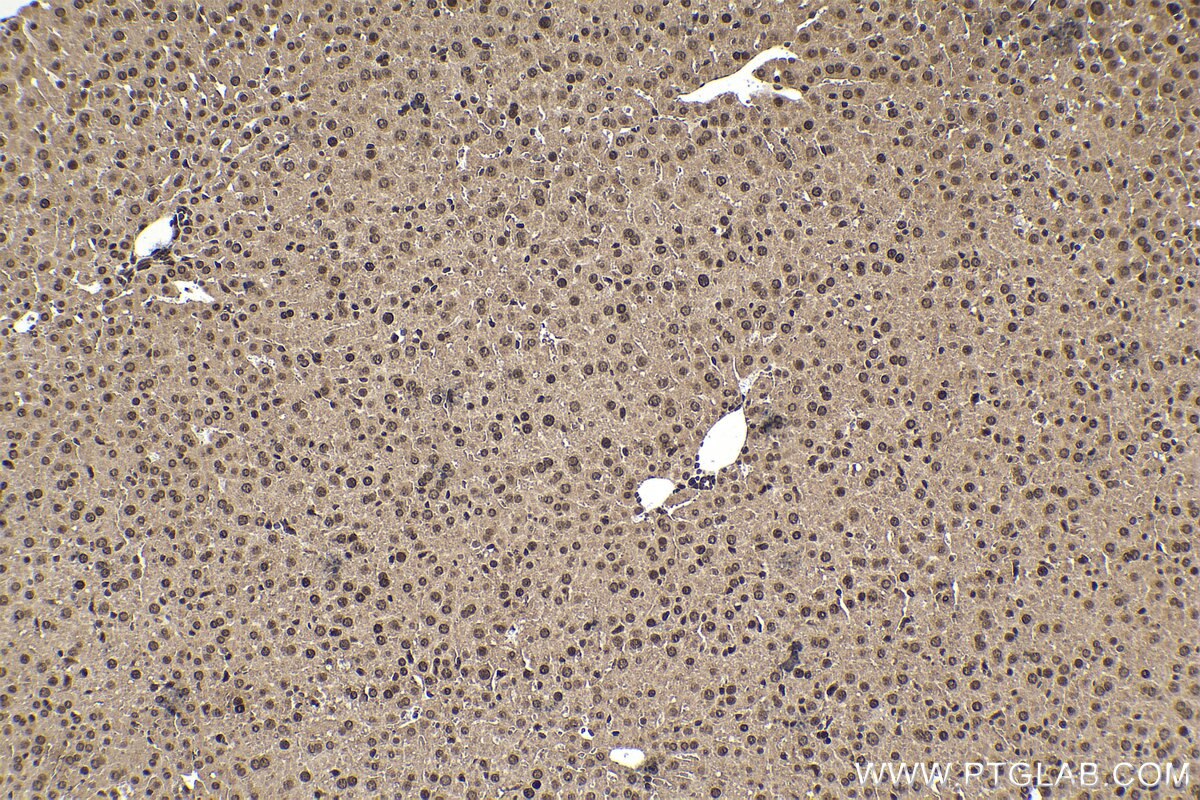 Immunohistochemistry (IHC) staining of mouse liver tissue using TIA1 Monoclonal antibody (68486-1-Ig)