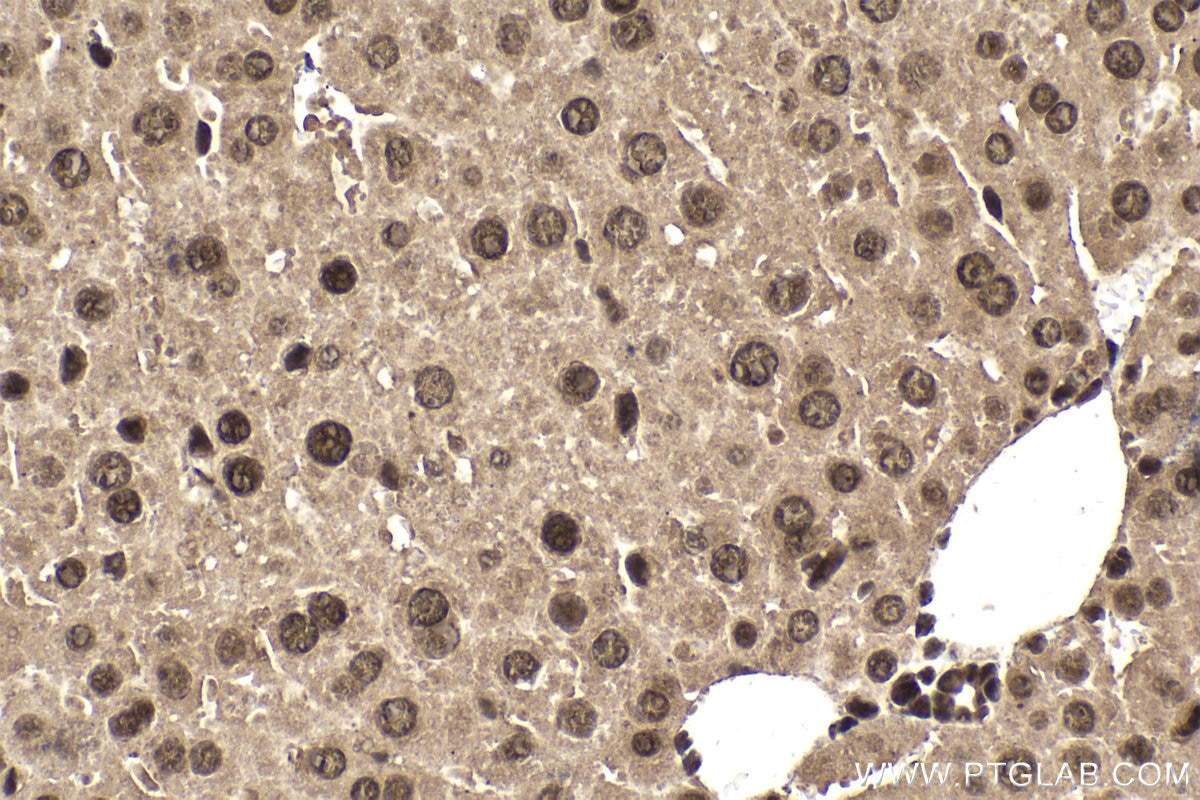 Immunohistochemistry (IHC) staining of mouse liver tissue using TIA1 Monoclonal antibody (68486-1-Ig)