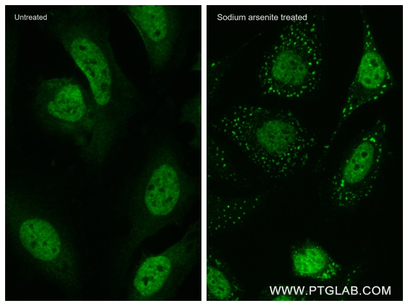 Immunofluorescence (IF) / fluorescent staining of HeLa cells using TIA1 Recombinant antibody (82672-1-RR)