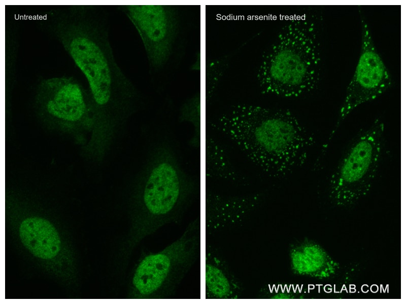 IF Staining of HeLa using 82672-1-RR